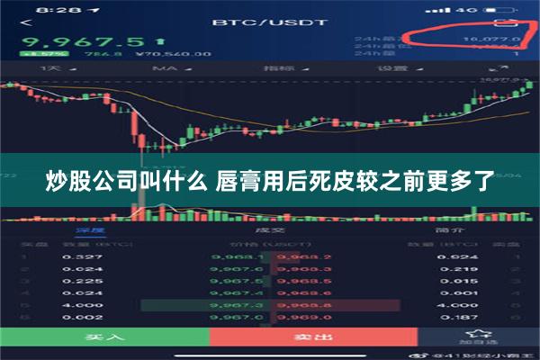 炒股公司叫什么 唇膏用后死皮较之前更多了