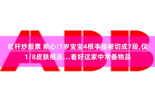 杠杆炒股票 揪心!1岁宝宝4根手指被切成7段,仅1/8皮肤相连…看好这家中常备物品